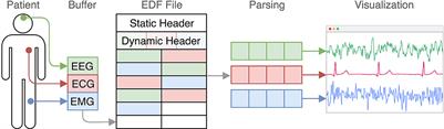 A Performant Web-Based Visualization, Assessment, and Collaboration Tool for Multidimensional Biosignals